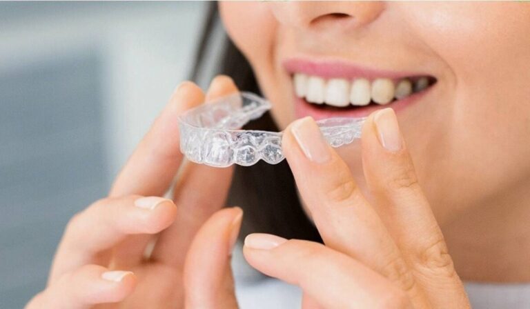 Şeffaf Plak (Invisalign) Tedavisi