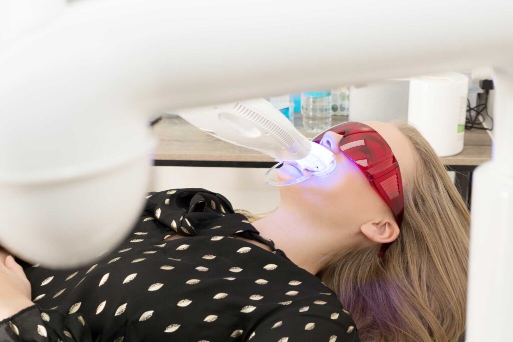 Diş Beyazlatma (Bleaching) Tedavisi