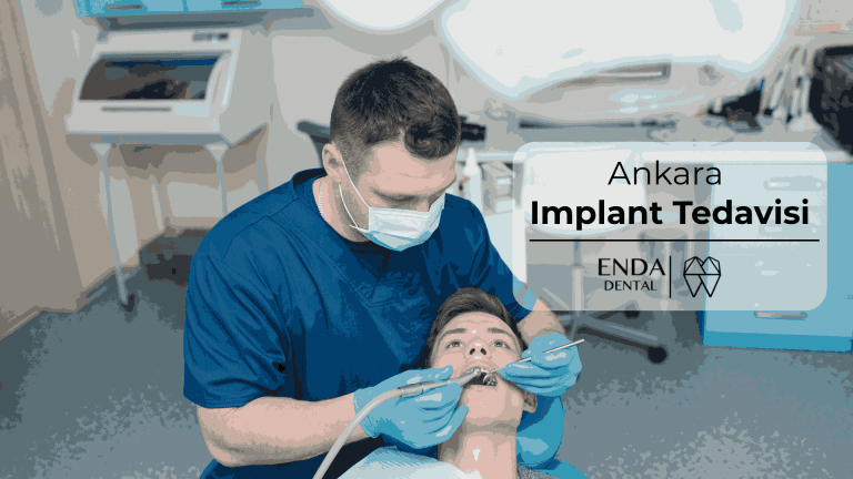 Ankara Diş İmplant Tedavisi