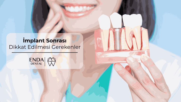 İmplant Sonrası Dikkat Edilmesi Gerekenler